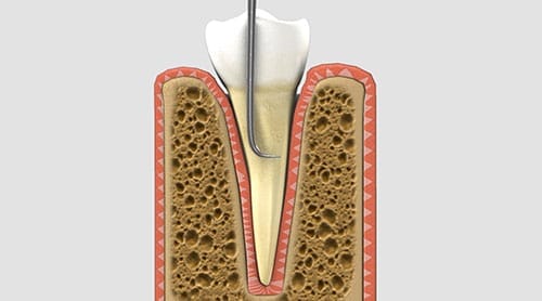 Infographic on health gums